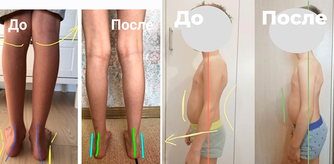Здоровые стопы и осанка за лето. Курс оздоровительных упражнений для детей 4-12 лет.png